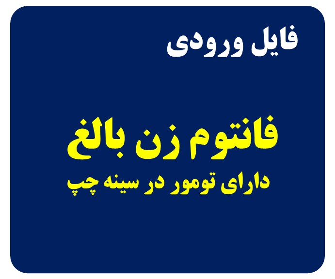 فانتوم زن بالغ شامل تومور در سینه چپ